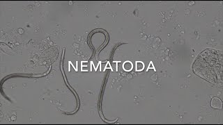 Nematodes [upl. by Nitsirt479]