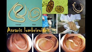 Ascaris lumbricoides [upl. by Iruam513]