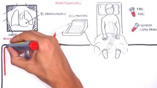 Acute Coronary Syndrome DETAILED Overview MI STEMI NSTEMI [upl. by Tailor]