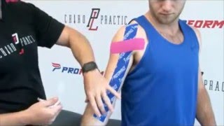 How to Apply PF Performance Tape  Bicep Tendon [upl. by Medina624]