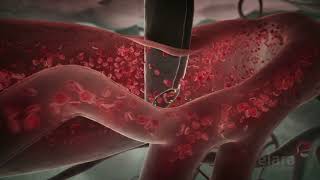 Malaria 3D Animation Shows How the Infection Spreads in the Body [upl. by Mik321]